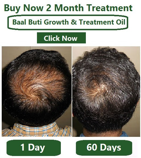 Baalbuti Advanced Hair Growth Serum | 100% Steam Distilled Rosemary & Caffeine Ark (50ml)