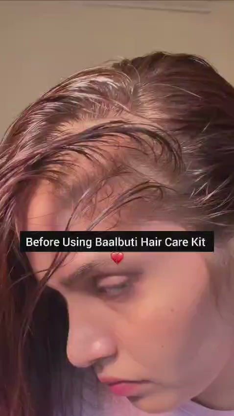Baalbuti Advanced Hair Growth Serum | 100% Steam Distilled Rosemary & Caffeine Ark (50ml)